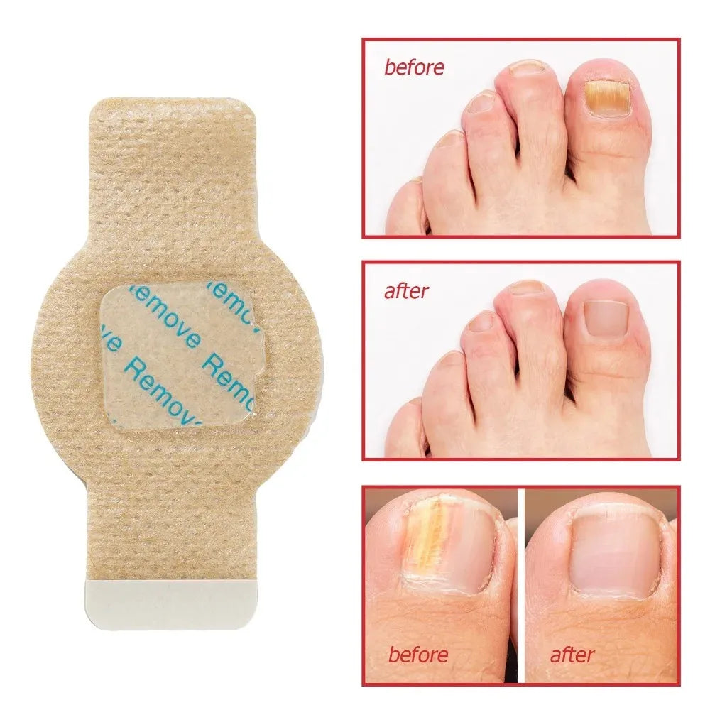 RestorePatch™ Overnight Nail Patches