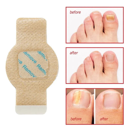 RestorePatch™ Overnight Nail Patches